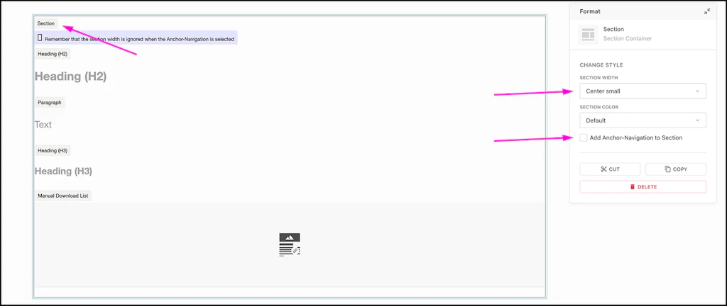 Screenshot of the Livingdocs backend to show the place of the button or text field mentioned in the text.