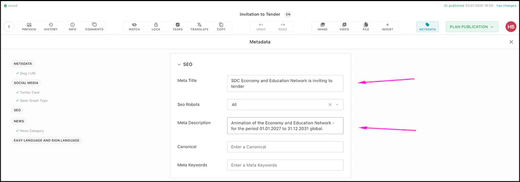 Screenshot of the Livingdocs backend to show the place of the button or text field mentioned in the text.